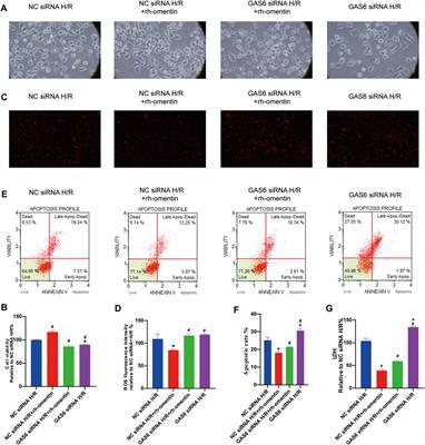 Neuroprotective Effects of Omentin-1 Against Cerebral Hypoxia/Reoxygenation Injury via Activating GAS6/Axl Signaling Pathway in Neuroblastoma Cells